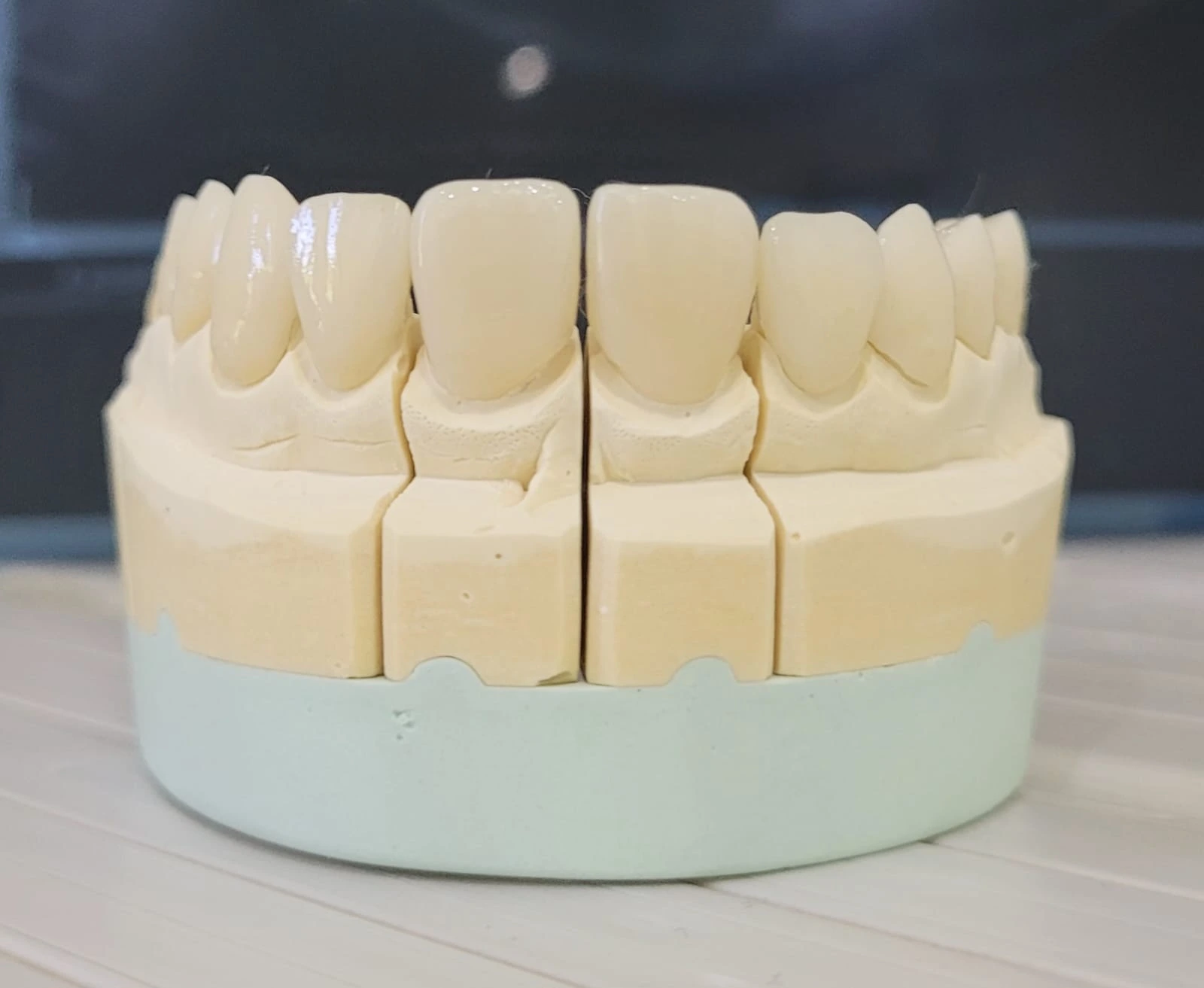 Odontóloga realizando un tratamiento de periodoncia.